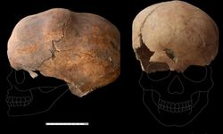 Yassıhöyük'te tarihi keşif: 6 bin yıllık kafatasında ameliyat izleri