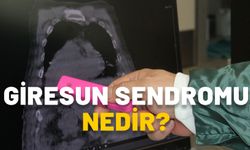 GİRESUN SENDROMU NEDİR, NASIL OLUR? Giresun’da görüldü, tıp literatürüne geçti