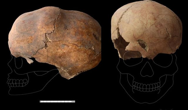 Yassıhöyük'te tarihi keşif: 6 bin yıllık kafatasında ameliyat izleri