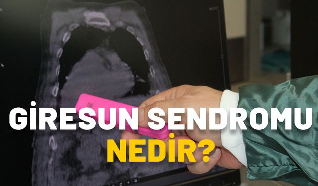 GİRESUN SENDROMU NEDİR, NASIL OLUR? Giresun’da görüldü, tıp literatürüne geçti